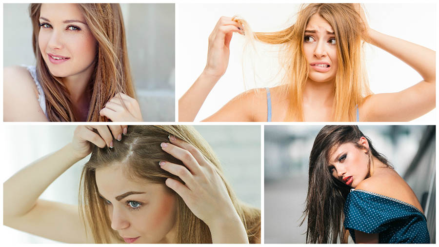 Hay algunos medicamentos que pueden ocasionar, de forma temporal, la caída del cabello en mujeres.