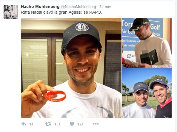 Aunque no haya confirmado nada, la prensa da por hecho que Nadal es otro de los famosos con injerto de pelo.