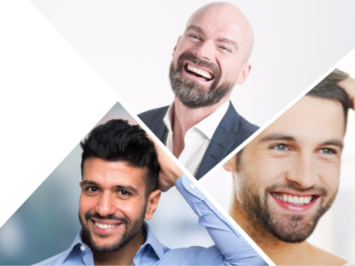 Para usar Finasteride con más eficacia debe tener una edad entre 18 y 40 años.