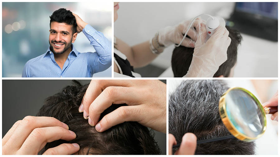 Cada vez son más los españoles que viajan a Estambul para realizarse un trasplante capilar en Turquía.